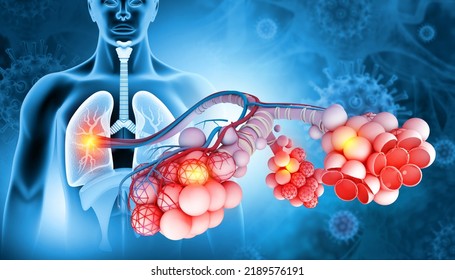 Alveoli In Lungs. Tiny Air Spaces In The Lungs Through Which Exchanges Oxygen And Carbon Dioxide. 3d Illustration