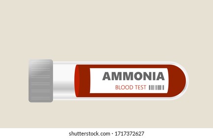 Ammonia Level Blood Test For Hepatic Encephalopathy Reye Syndrome Or Urea Cycle Disorders In Blood Sample Vial