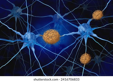 Amyloid Plaques concept as abnormal clusters of protein fragments that accumulate between nerve cells in the brain resulting in degenerative disease as Alzheimers and dementia as a 3D illustration.
