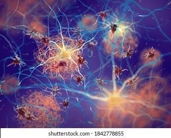 Amyloid plaques forming between neurons 3d ilustration. Beta-amyloid protein disrupting nerve cells function in a brain with Alzheimer's disease