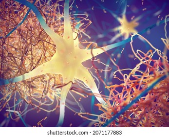 Amyloid plaques forming between neurons 3d illustration. Beta-amyloid protein disrupting nerve cells function in a brain with Alzheimer's disease