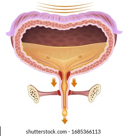 Anatomical And Descriptive Illustration Of The Problem Bladder
Urinary Incontinence.