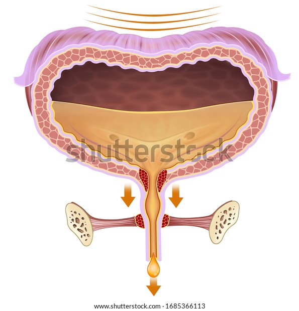 Anatomical Descriptive Illustration Problem Bladder Urinary Stock ...