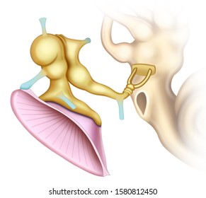 Anatomical and descriptive illustration of the tympanic membrane, the anvil and stirrup bones and in the background the auditory conch.