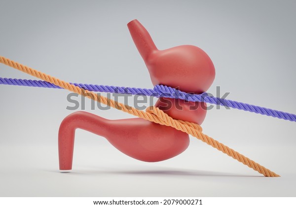 Anatomical\
model of human stomach, tied with rope.\
concept for stomach\
cramps, feelings of hunger. 3d\
rendering.