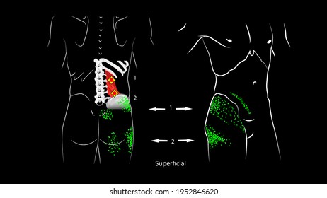 Anatomy Deep Superficial Trigger Points Quadratus Stock Illustration ...