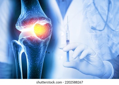 Anatomy Human Knee Joint Treatment, Osteoarthritis Injection, Drug Method Injection, knee injury, 3d illustration - Powered by Shutterstock