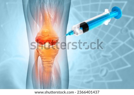 Anatomy Human Knee Joint Treatment, Osteoarthritis Injection, Drug Method Injection, knee injury, 3d illustration Foto stock © 