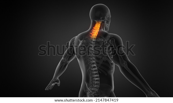 Anatomy of\
Human Spine. Neck pain.3d\
illustration.