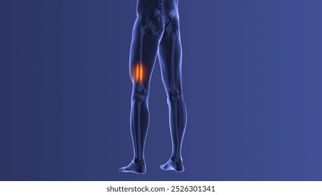 Anatomy of left side leg discomfort 3d illustration - Powered by Shutterstock