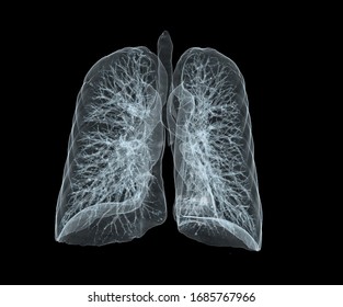 Anatomy Of The Lungs By Transparency.CT 3D SCAN 