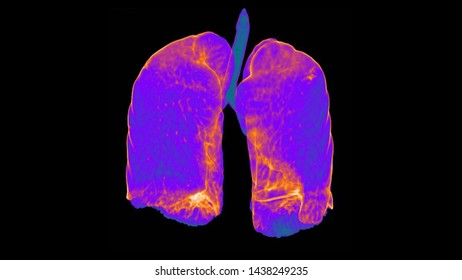 Anatomy Of The Lungs By Transparency Technic With Heat Map Color .CT 3D SCAN