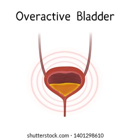 Anatomy Picture Overactive Bladder Realistic Medical Stock Illustration ...