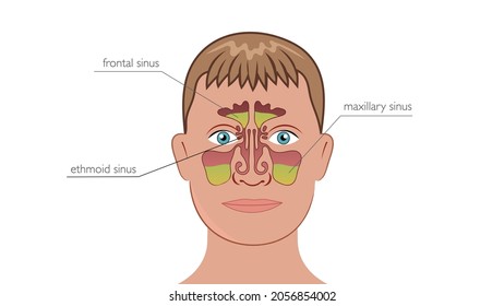 
Anatomy Of The Sinuses Of The Nose And Nose. Maxillary Sinus, Frontal Sinus And Ethmoid Sinus