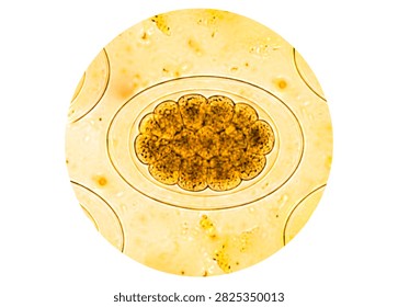 Ancylostoma spp or Hook worm eggs of pasasite in stool examination.