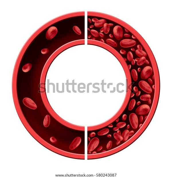 白い背景に3dイラストとしての貧血と貧血の医学図のコンセプトは 正常で異常な血球数と 動脈または静脈内のヒトの循環とです のイラスト素材