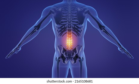 Animation Of A Painful Lumbar Spine. 3d Illustration.