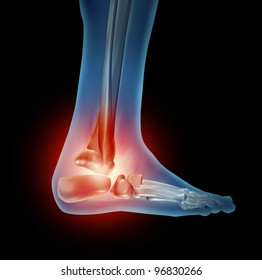 Ankle Foot Pain Skeleton Body Part Stock Illustration 96830266