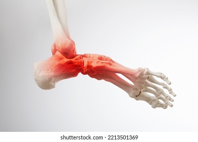 Ankle pain and foot painful poin, 3d illustration	
 - Powered by Shutterstock