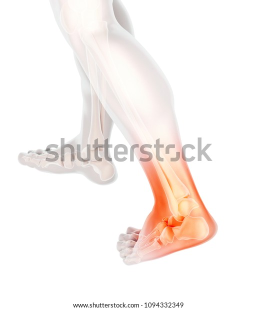 足首の痛み 骸骨x線 3dイラスト医療コンセプト のイラスト素材