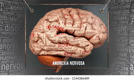 Anorexia Nervosa Anatomy Causes Effects Projected Stock Illustration ...