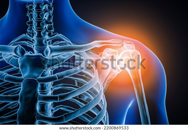 Anterior or front view of human shoulder joint\
and bones with inflammation 3D rendering illustration. Pathology,\
articular pain, anatomy, osteology, rheumatism, medical and\
healthcare\
concept.