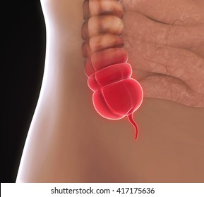 Appendix Pain Illustration. 3D Rendering