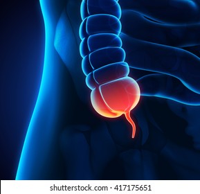 Appendix Pain Illustration. 3D Rendering