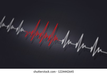 Arrythmia Medical Illustration Of Heart Irregular Pulsating 