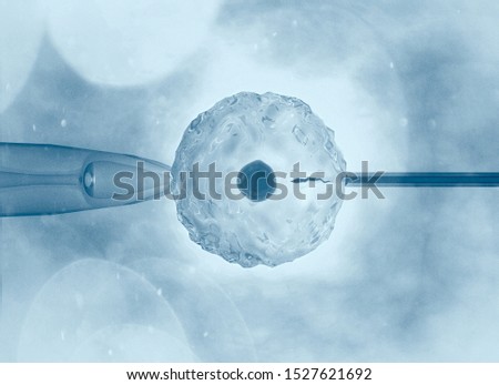 Artificial or assisted fertilization is the process by which the union of gametes is artificially carried out, by observation under a microscope, 3d rendering