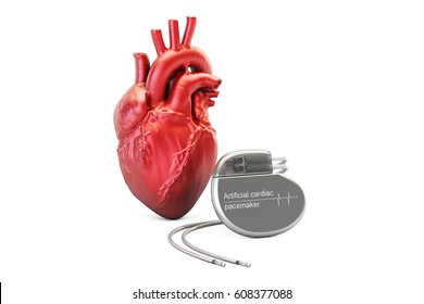 Artificial Cardiac Pacemaker, 3D Rendering Isolated On White Background