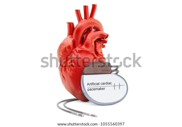 白い背景に人工心臓のペースメーカーと人間の心 3dレンダリング のイラスト素材