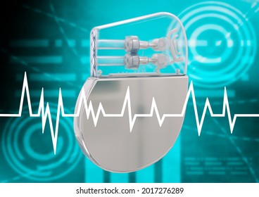 Artificial Cardiac Pacemaker Isolated On Graphic Background. 3D Rendering