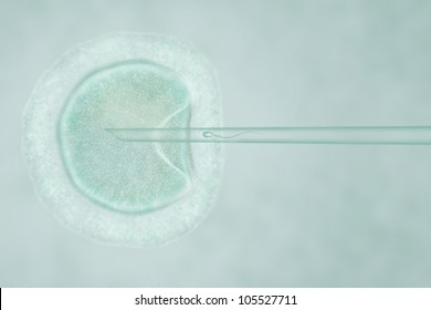Artificial Insemination by Intracytoplasmic Sperm Injection