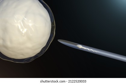 Intracytoplasmic Sperm Injection Images Stock Photos Vectors Shutterstock