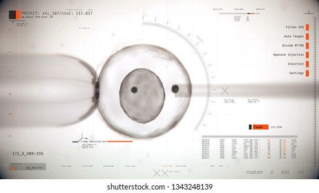 Artificial insemination procedure under microscope, infertility treatment, AI