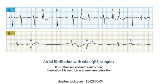 100 Wide qrs Images, Stock Photos & Vectors | Shutterstock