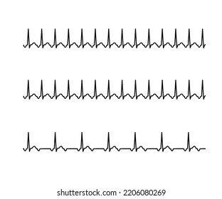 Atrial Tachycardia
Abnormality Arrhythmia Atrial Tachycardia Circulatory System