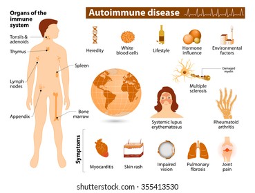 Autoimmune disease infographic. Medical Infographic set elements and symbols for design.