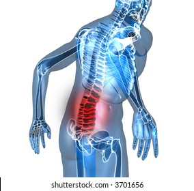 34,191 Back pain Stock Illustrations, Images & Vectors | Shutterstock