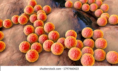 staphylococcus epidermis epidermidi
