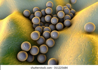 Bacteria Staphylococcus Aureus On Surface Skin Stock Illustration ...