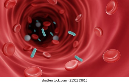 Bacterial sepsis, Bloodstream infection 3d illustration