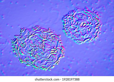 Bacterial Vaginosis 3d Illustrations Showing Epithelial 库存插图 1928197388 ...