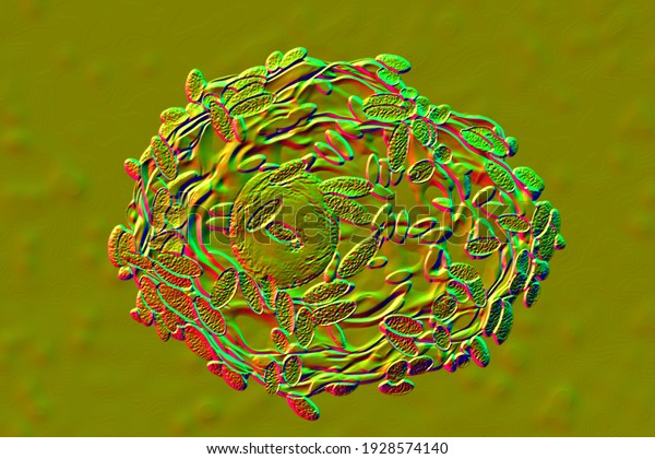 Bacterial Vaginosis 3d Illustrations Showing Epithelial Stock ...