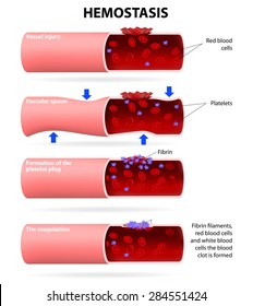 Basic Steps In Hemostasis