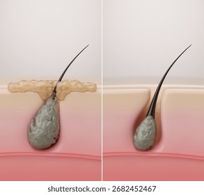 Before and after of deep pore cleansing, showing a clogged hair follicle with a sebum plug transforming into a clean and healthy state. conceptual 3d illustration.