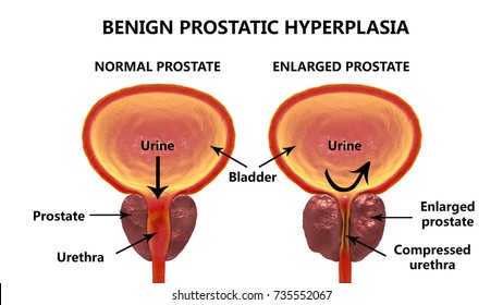 Stock fotó — Normal prostate gland isolated on white background, 3D illustration