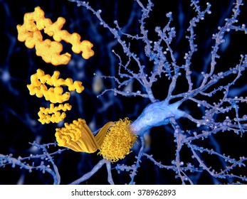 The beta amyloid peptid, amyloid plaques growing on a neuron.
It consists of about 30 amino acids and aggregates to amyloid plaques, that may damage and kill neurons.