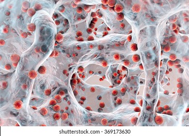 Biofilm Of Antibiotic Resistant Bacteria, Closeup View. Staphylococci, Spherical Bacteria, MRSA, Methicillin-resistant Staphylococcus Aureus